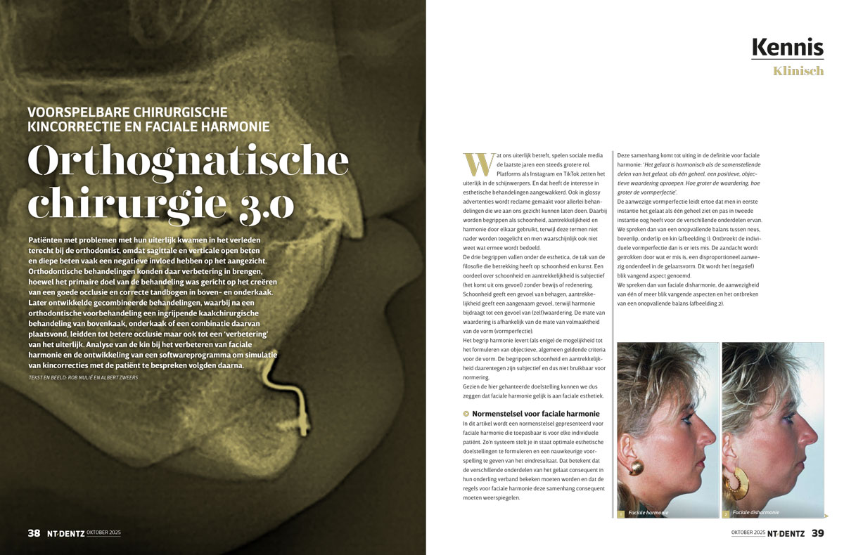 artikel NL Dentz Brons Mulie Methode NL