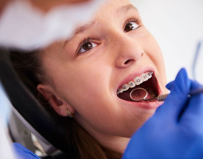 Beugels bij kinderen